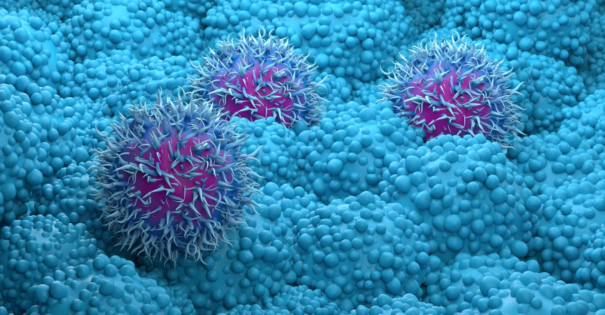 Pancreatic cancer used to be a death sentence. But new treatments are getting us closer to a cure.
