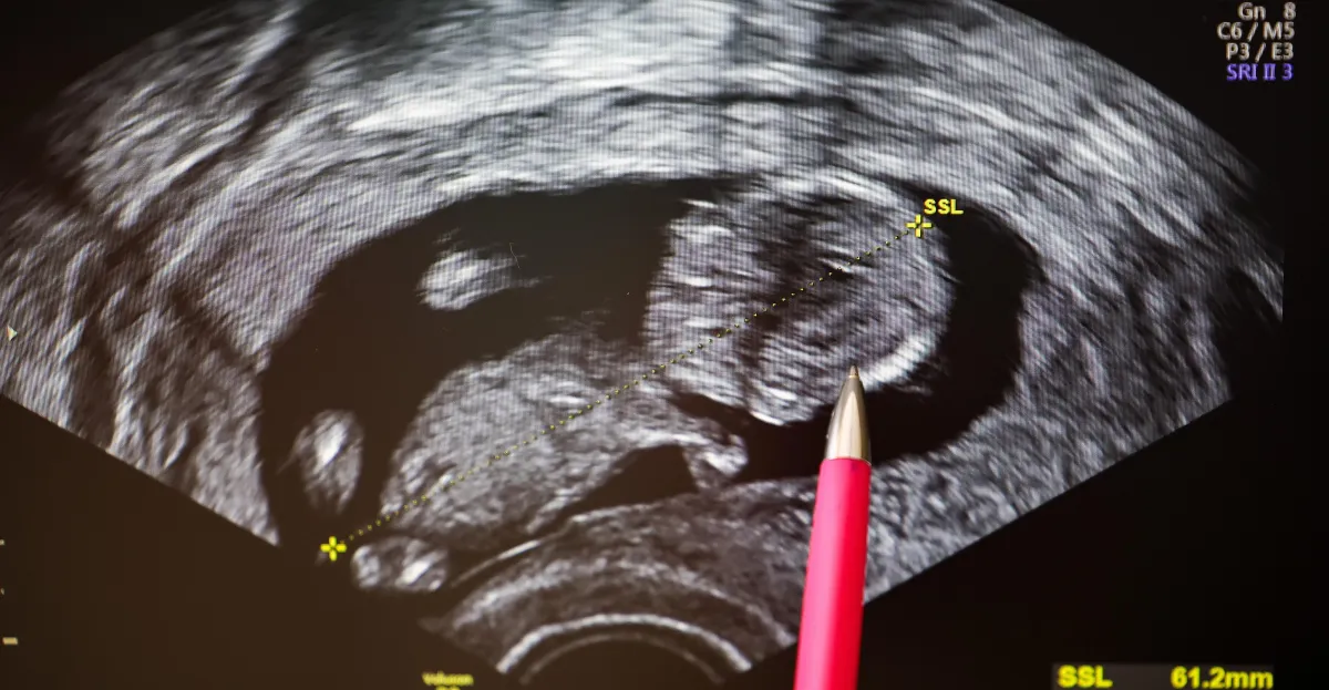 Should you get genetic screening before you have a child?